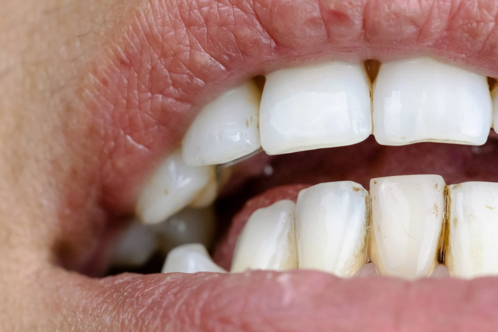Diabetes mellitus e saúde oral