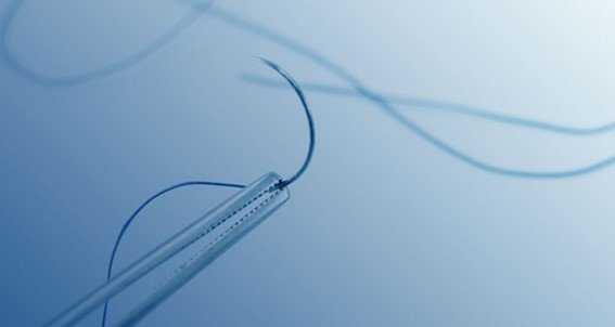 Importância da sutura e o que fazer após uma extração dentária