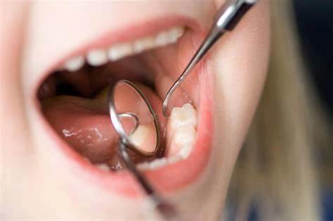 As funções da saliva e o porquê de ser tão importante escovar os dentes antes de dormir?